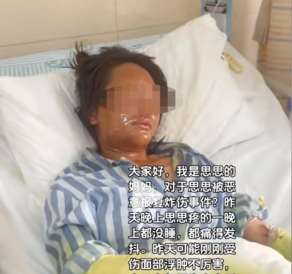 天龙配资 被伪装快递盒炸伤女主播: 嫌疑人放易燃物时疑戴面具, 被其骚扰两年